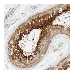 Atlas Antibodies Anti-AARSD1 Antibody