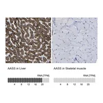 Atlas Antibodies Anti-AASS Antibody