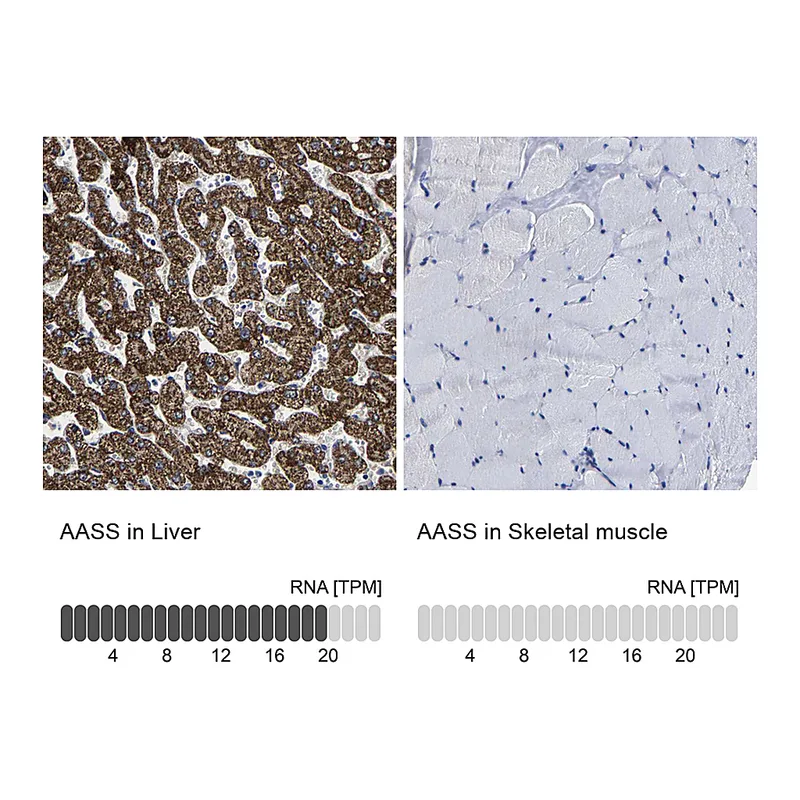 Atlas Antibodies Anti-AASS Antibody