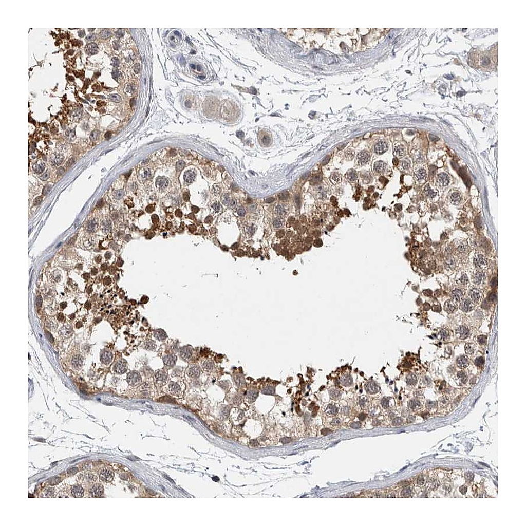 Atlas Antibodies Anti-AASDHPPT Antibody