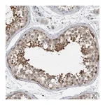 Atlas Antibodies Anti-AASDHPPT Antibody