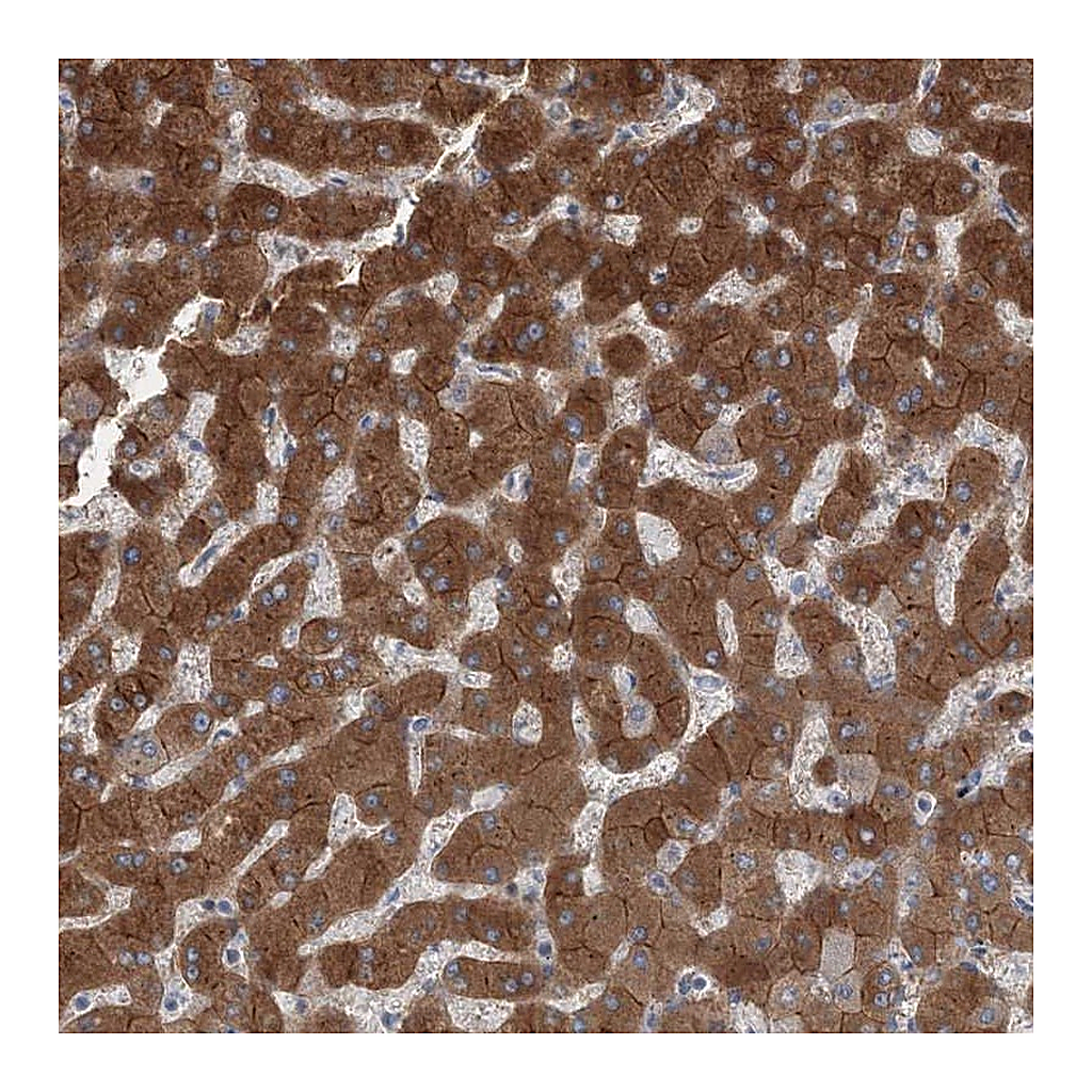 Atlas Antibodies Anti-AASDH Antibody