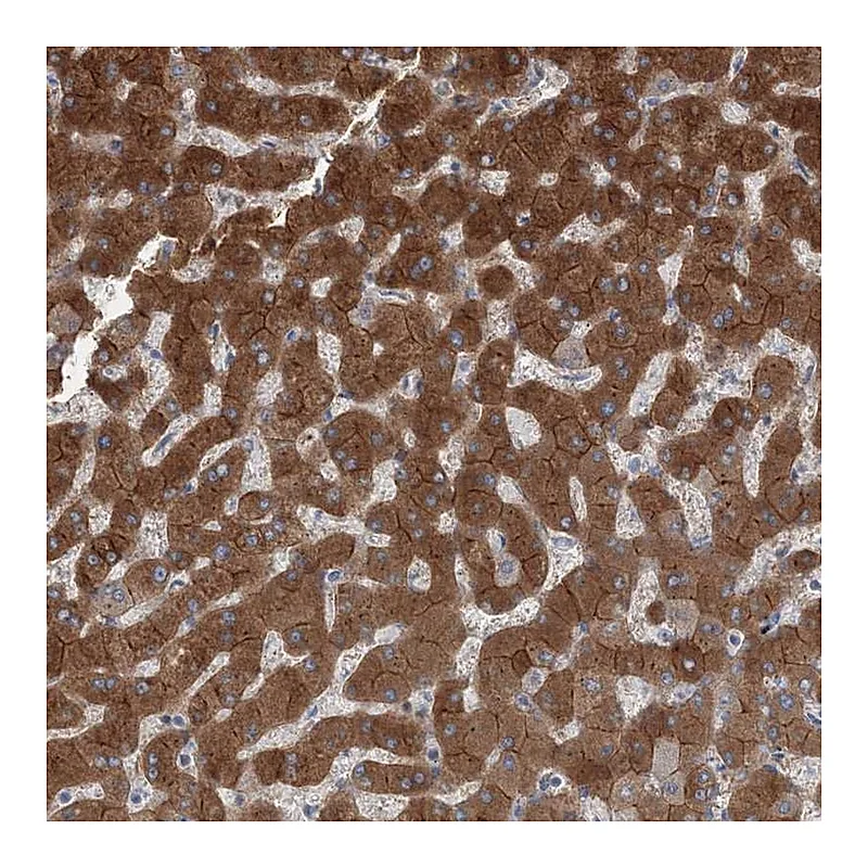 Atlas Antibodies Anti-AASDH Antibody