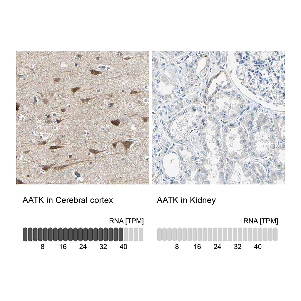 Atlas Antibodies Anti-AATK Antibody