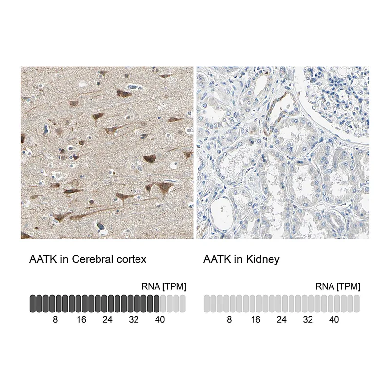 Atlas Antibodies Anti-AATK Antibody