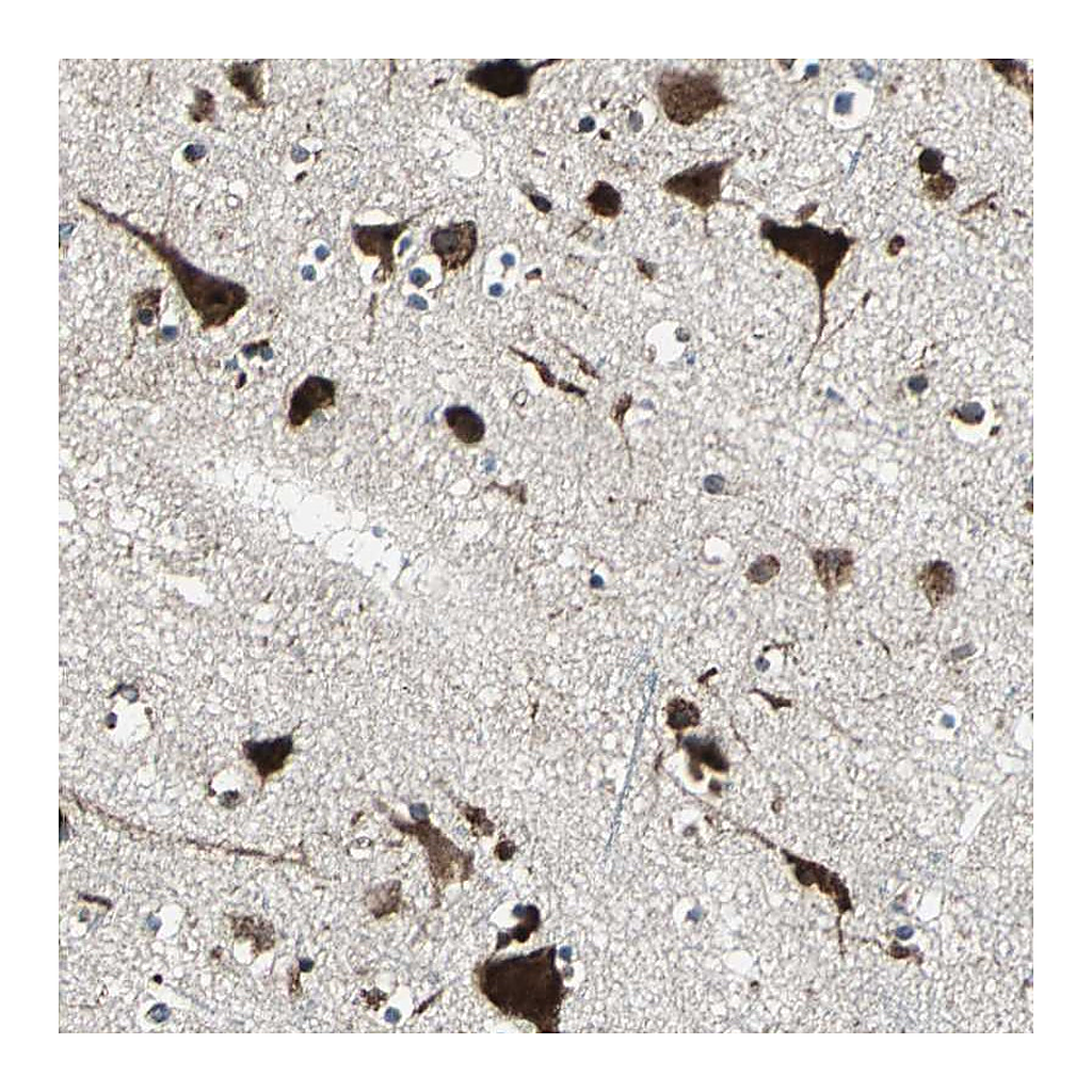Atlas Antibodies Anti-AATF Antibody