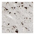 Atlas Antibodies Anti-AATF Antibody