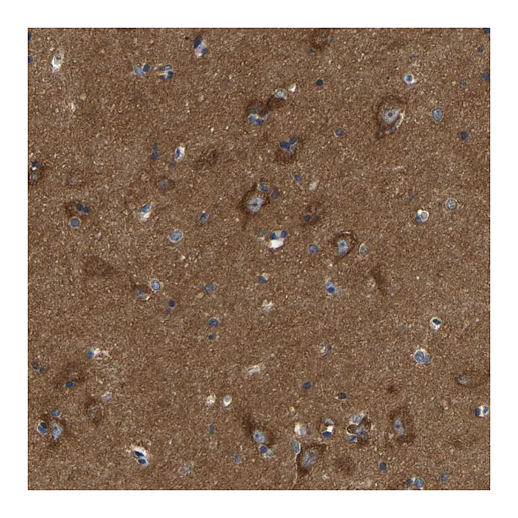 Atlas Antibodies Anti-ABCA10 Antibody