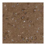 Atlas Antibodies Anti-ABCA10 Antibody