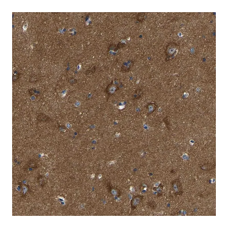 Atlas Antibodies Anti-ABCA10 Antibody