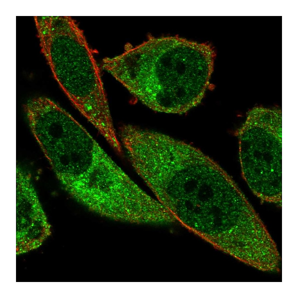 Atlas Antibodies Anti-ABCA13 Antibody