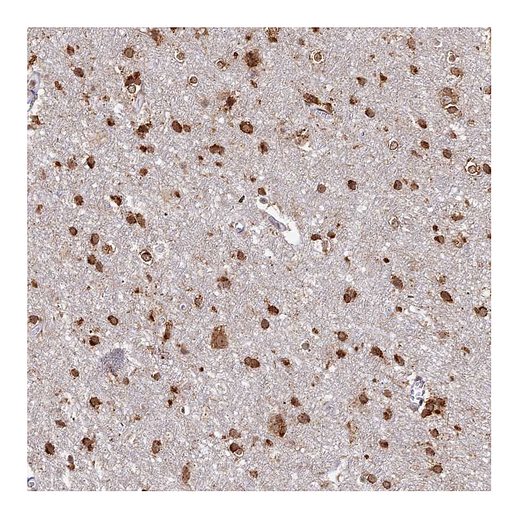 Atlas Antibodies Anti-ABCA2 Antibody