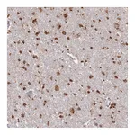 Atlas Antibodies Anti-ABCA2 Antibody