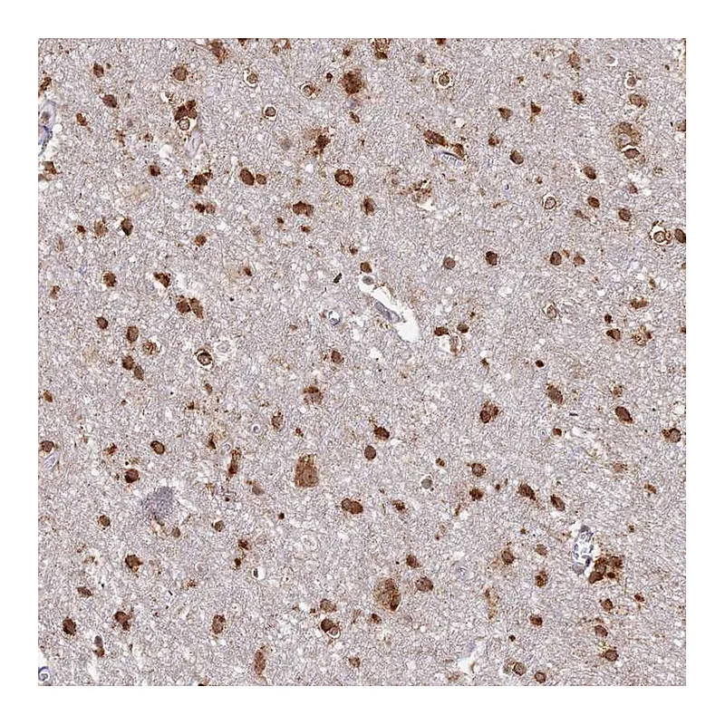 Atlas Antibodies Anti-ABCA2 Antibody
