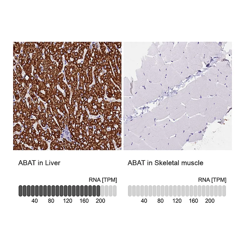 Atlas Antibodies Anti-ABAT Antibody