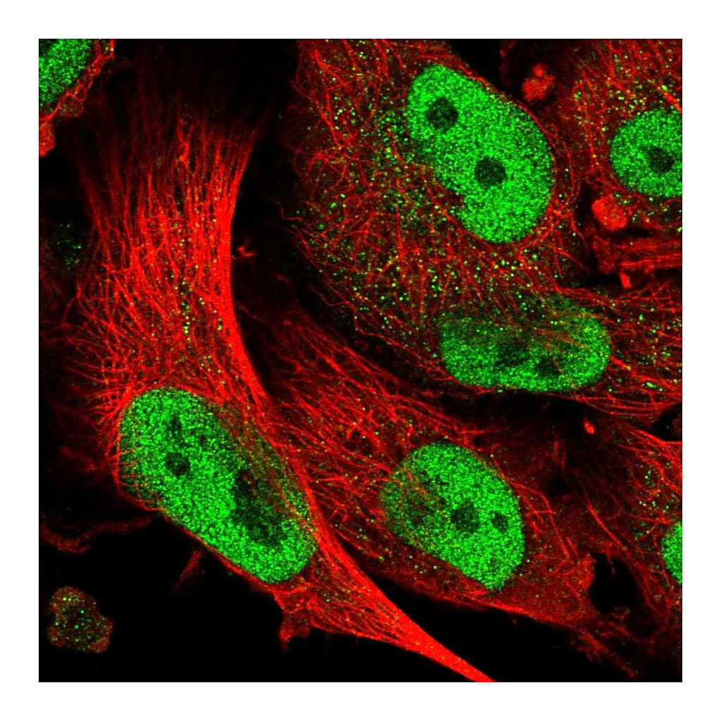 Atlas Antibodies Anti-ABCA1 Antibody