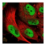 Atlas Antibodies Anti-ABCA1 Antibody
