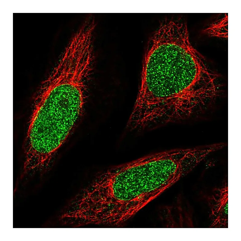 Atlas Antibodies Anti-ABCA5 Antibody