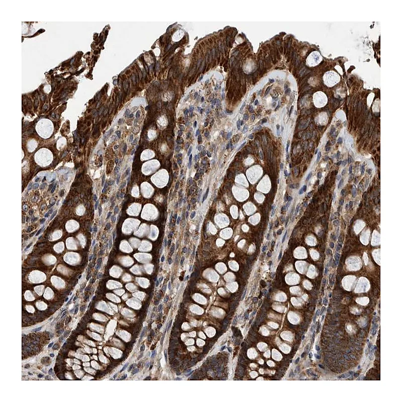 Atlas Antibodies Anti-ABCA5 Antibody