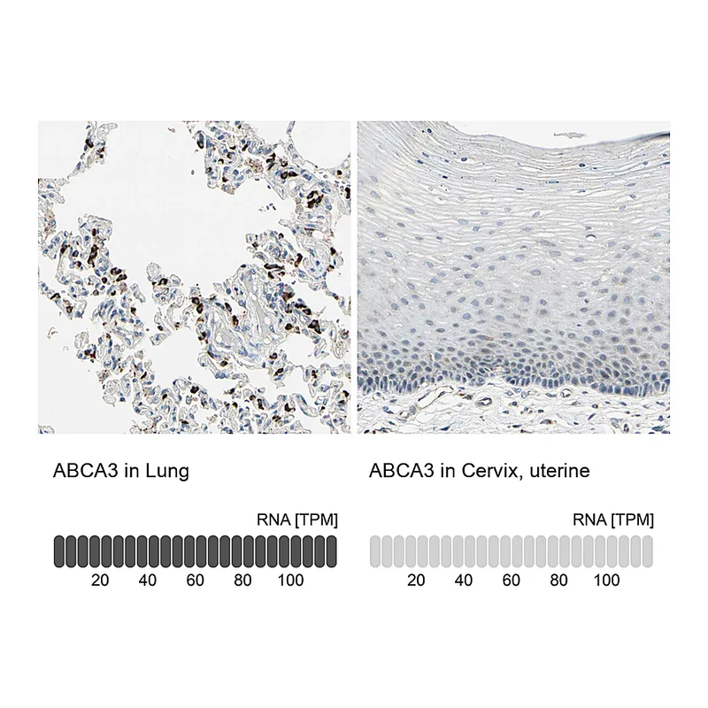 Atlas Antibodies Anti-ABCA3 Antibody
