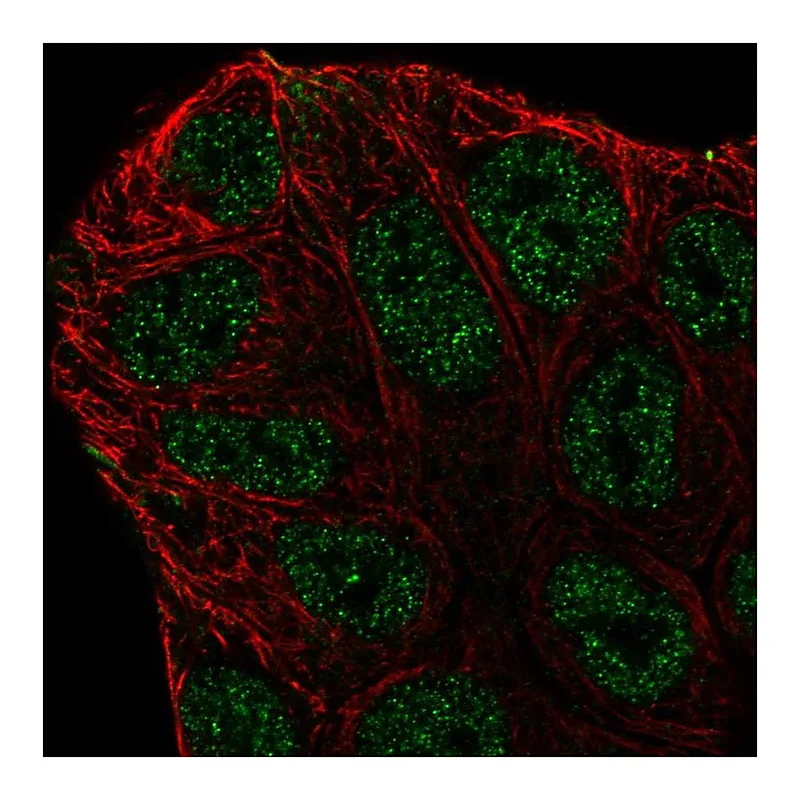 Atlas Antibodies Anti-ABCA6 Antibody