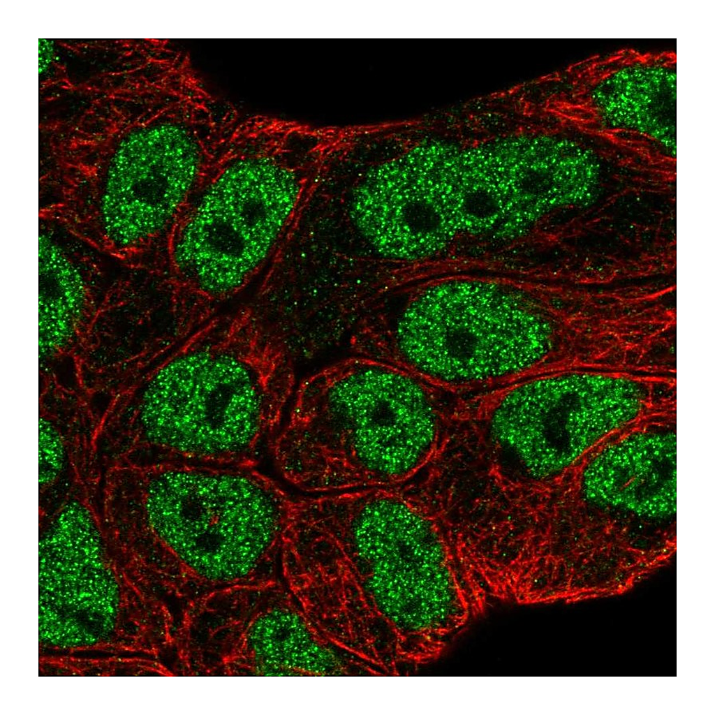Atlas Antibodies Anti-ABCA6 Antibody