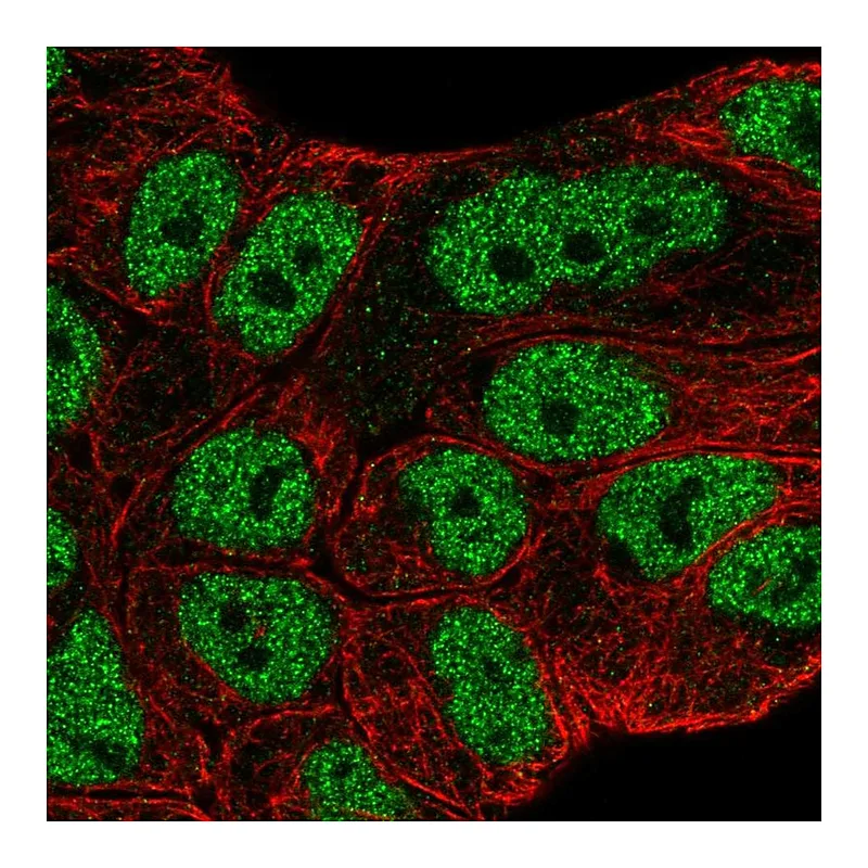 Atlas Antibodies Anti-ABCA6 Antibody
