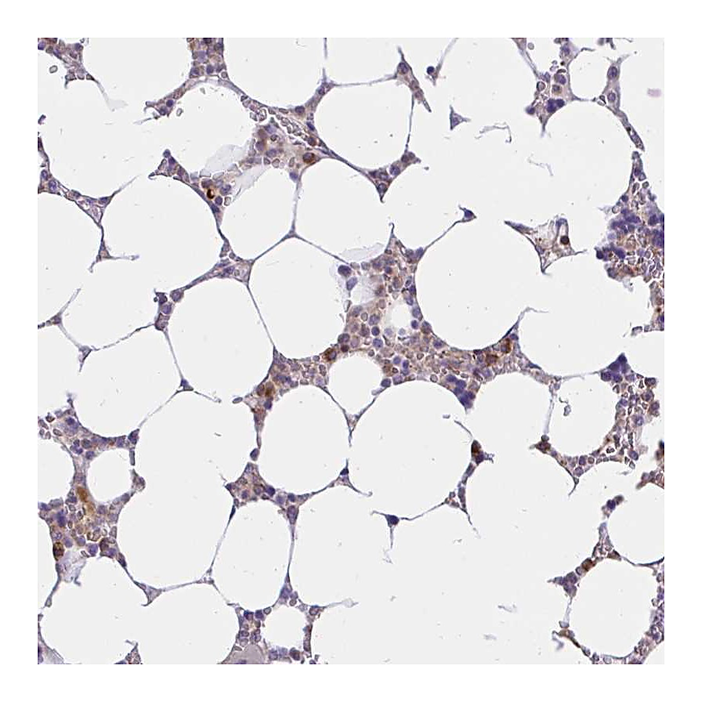 Atlas Antibodies Anti-ABCB10 Antibody