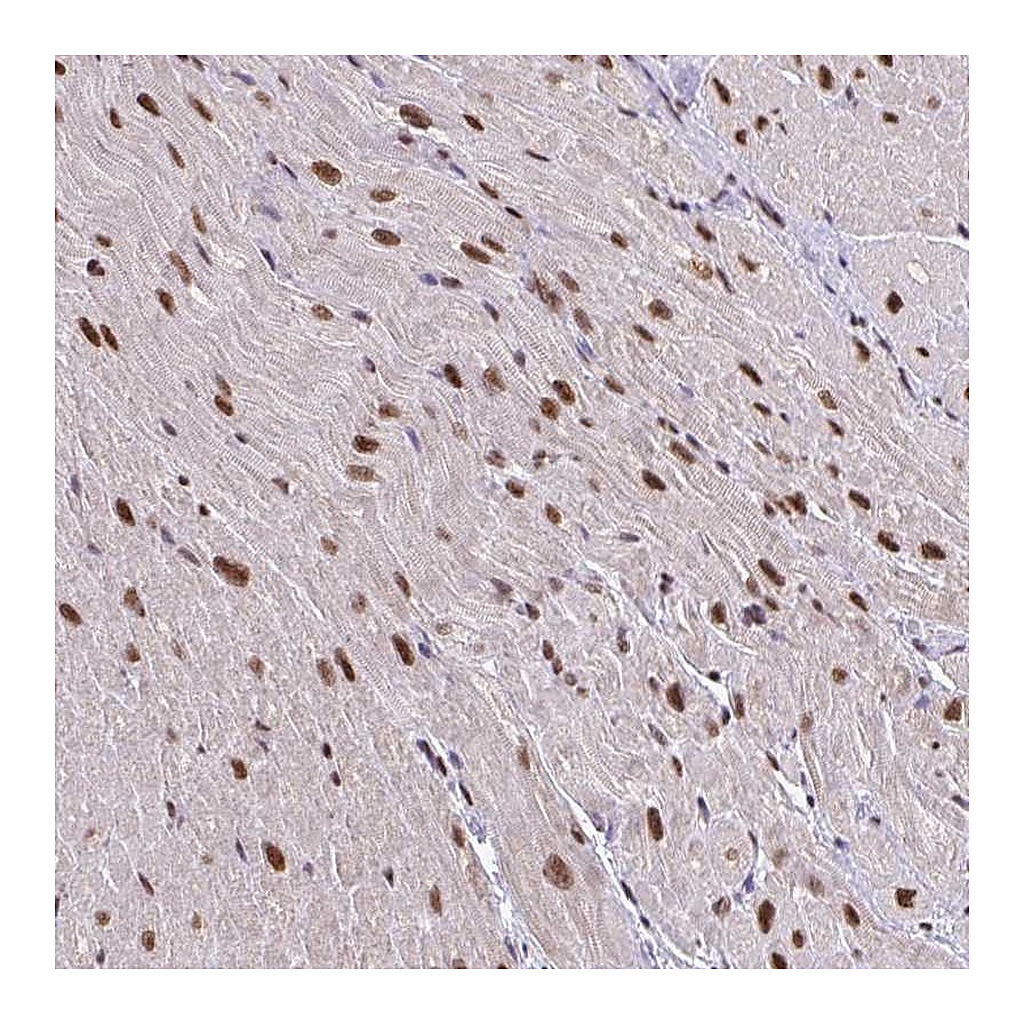 Atlas Antibodies Anti-ABCA9 Antibody