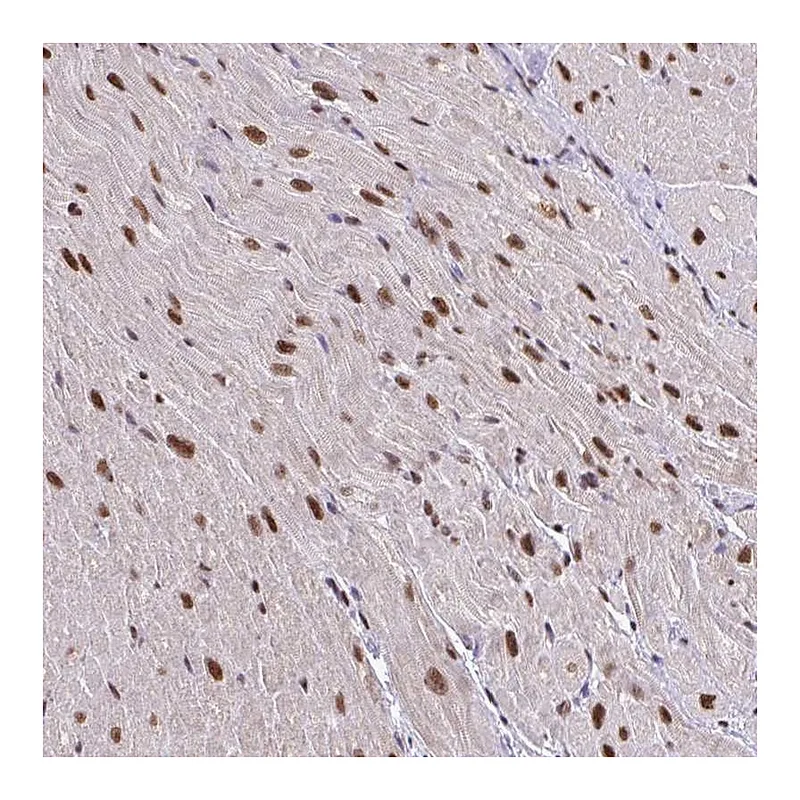 Atlas Antibodies Anti-ABCA9 Antibody