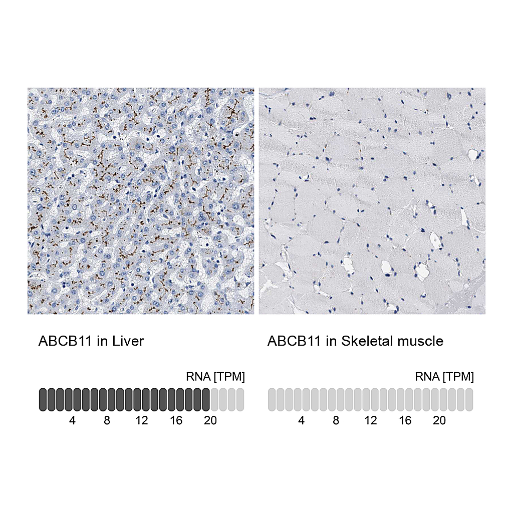 Atlas Antibodies Anti-ABCB11 Antibody