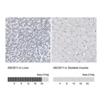 Atlas Antibodies Anti-ABCB11 Antibody
