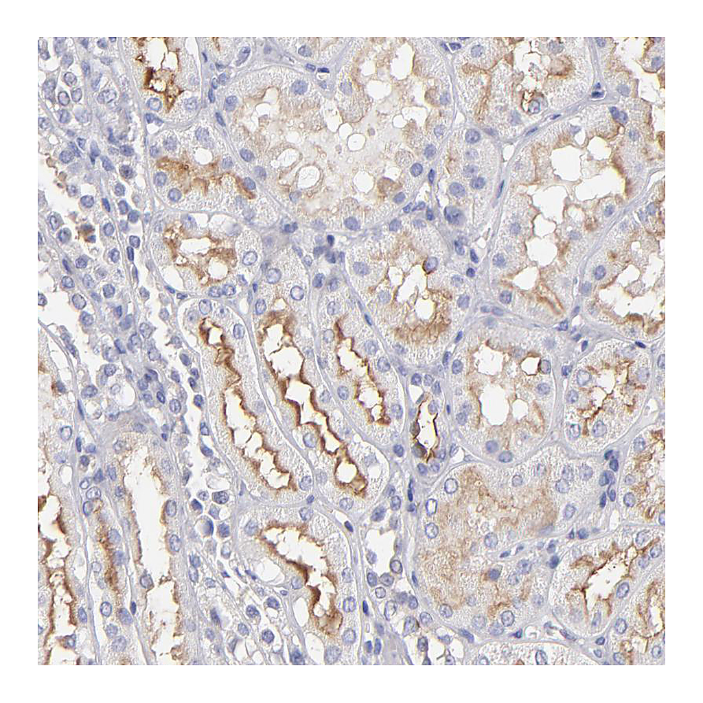Atlas Antibodies Anti-ABCB1 Antibody