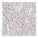 Atlas Antibodies Anti-ABCB1 Antibody