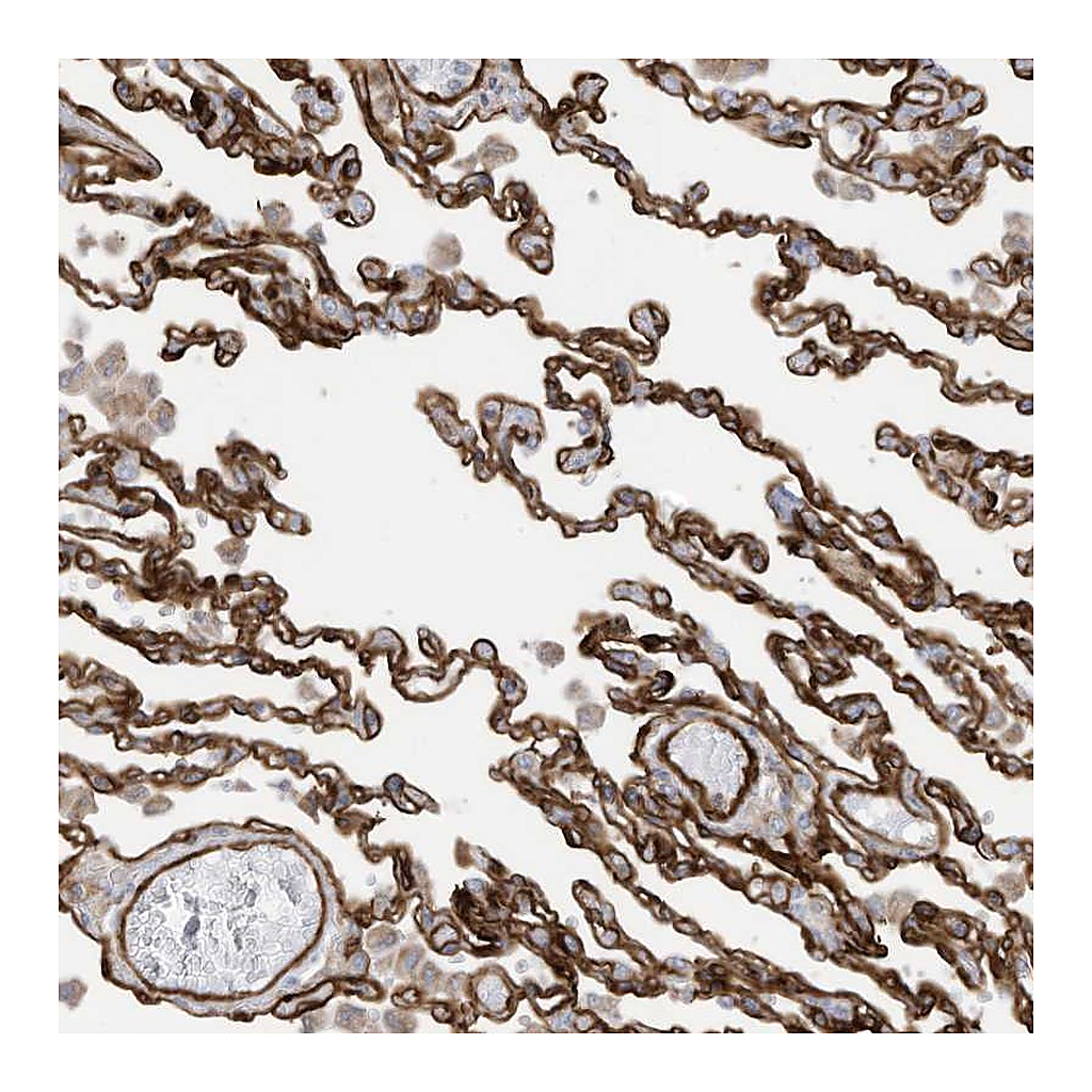 Atlas Antibodies Anti-ABCB7 Antibody