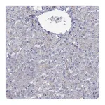Atlas Antibodies Anti-ABCB4 Antibody