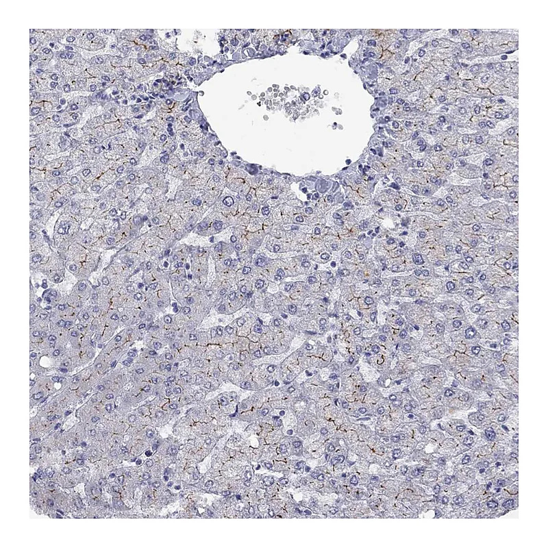 Atlas Antibodies Anti-ABCB4 Antibody