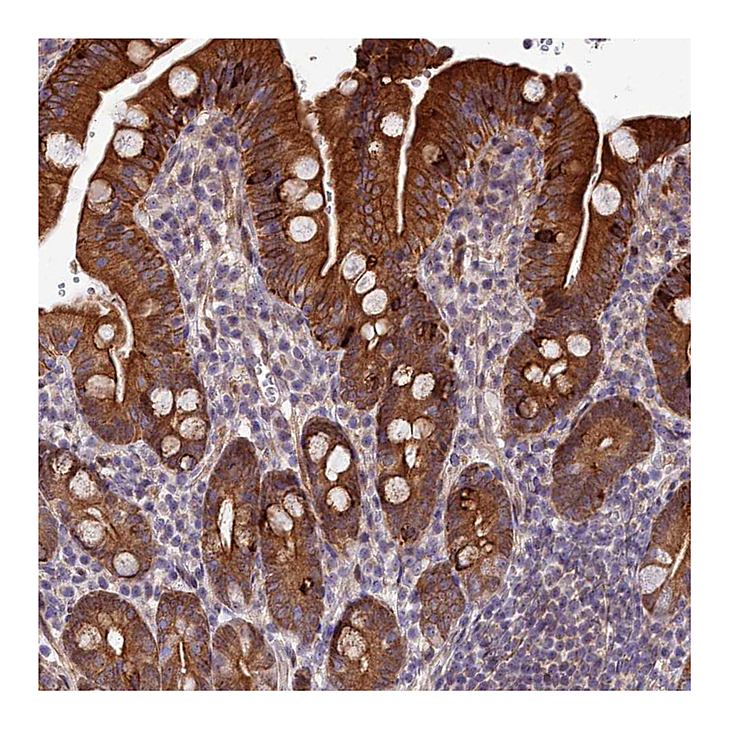 Atlas Antibodies Anti-ABCB8 Antibody