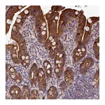 Atlas Antibodies Anti-ABCB8 Antibody