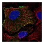 Atlas Antibodies Anti-ABCB1 Antibody