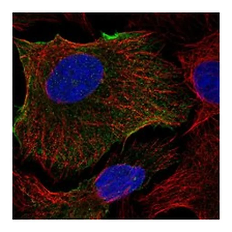 Atlas Antibodies Anti-ABCB1 Antibody