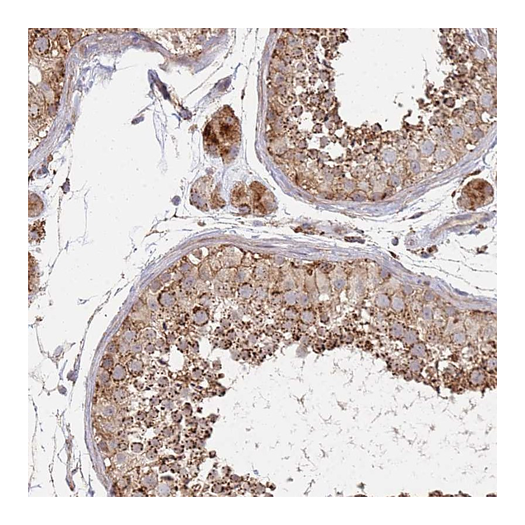 Atlas Antibodies Anti-ABCB6 Antibody