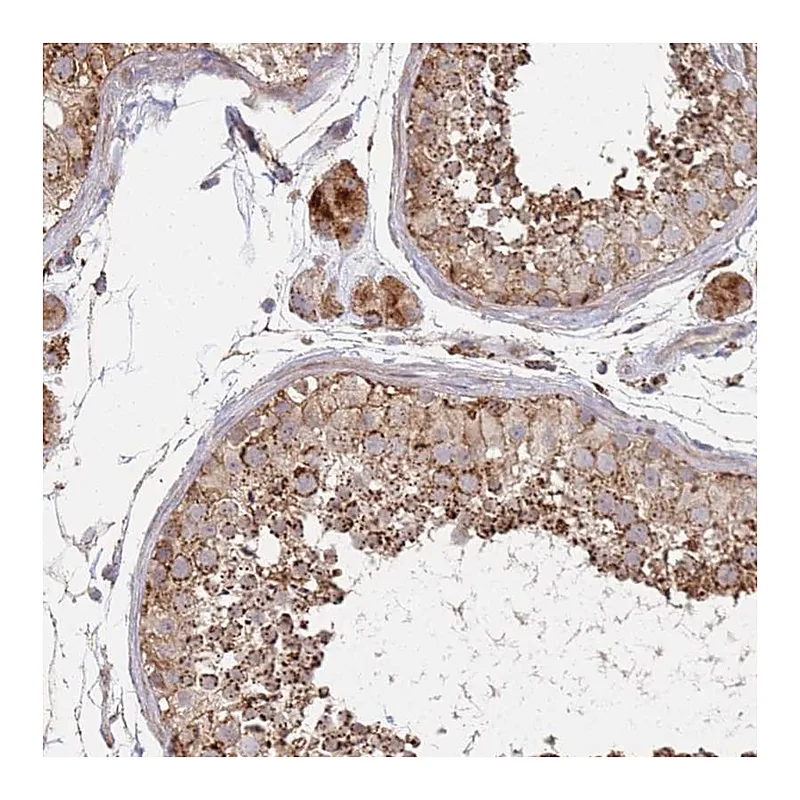 Atlas Antibodies Anti-ABCB6 Antibody
