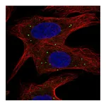 Atlas Antibodies Anti-ABCB9 Antibody