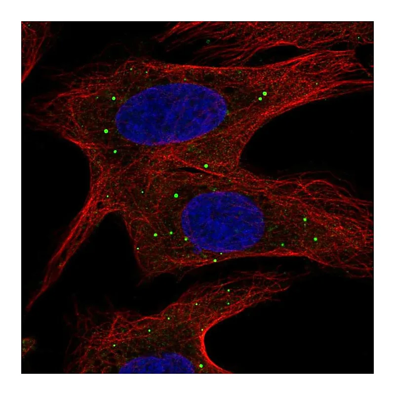 Atlas Antibodies Anti-ABCB9 Antibody