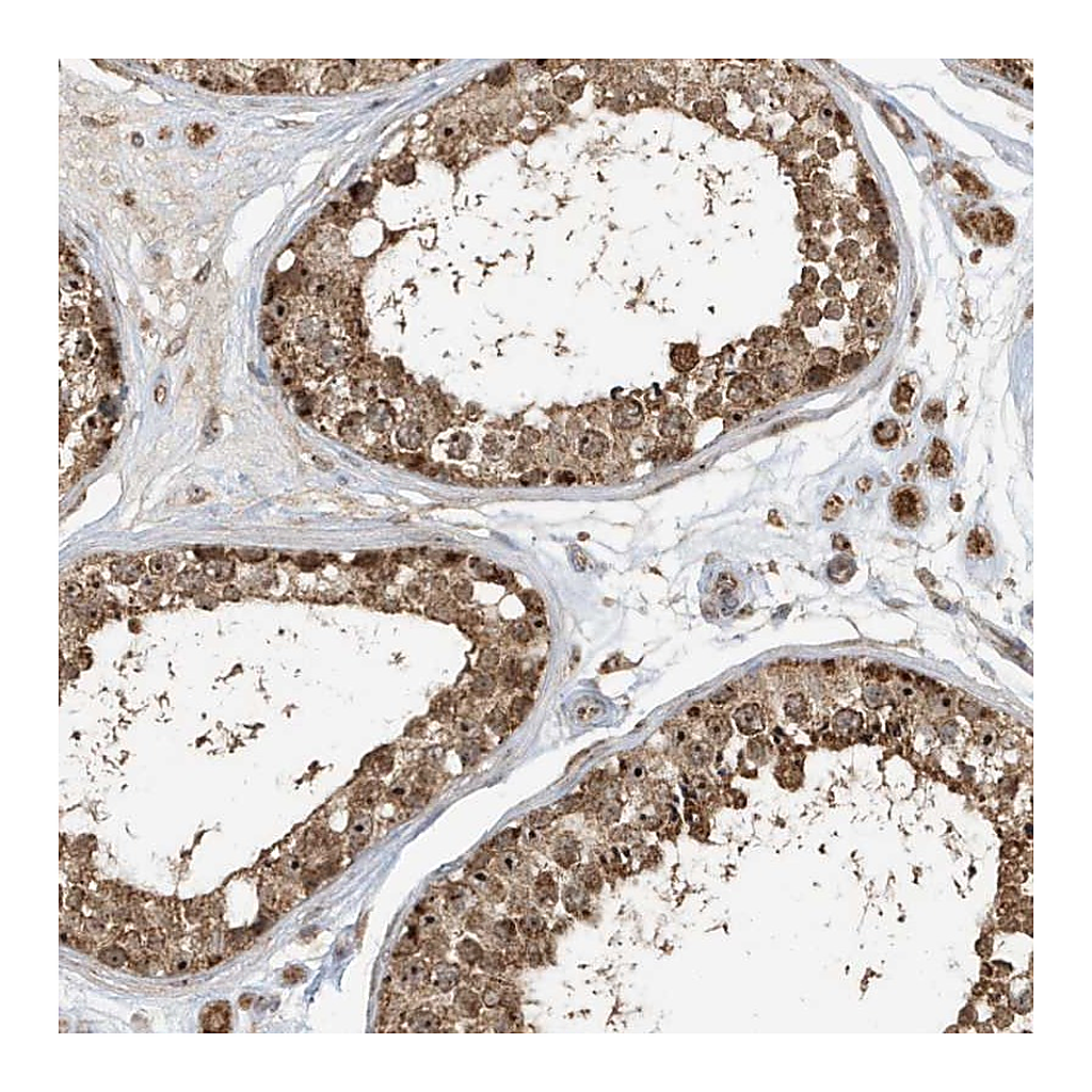 Atlas Antibodies Anti-ABCB9 Antibody