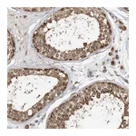 Atlas Antibodies Anti-ABCB9 Antibody