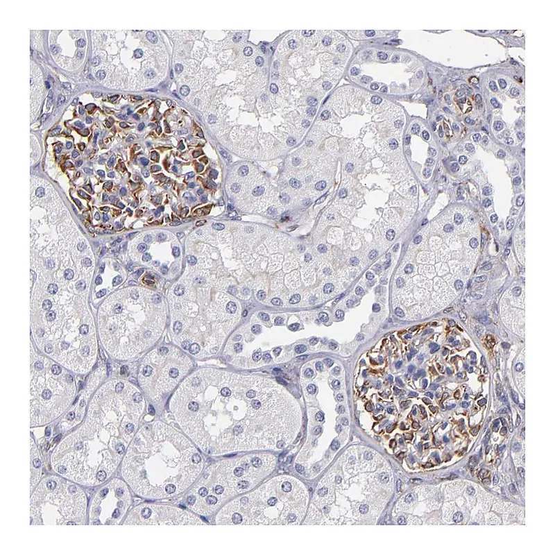 Atlas Antibodies Anti-ABCC1 Antibody