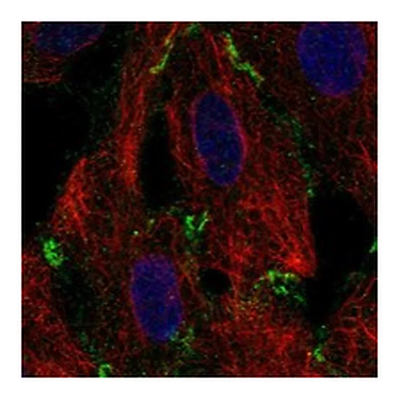 Atlas Antibodies Anti-ABCC1 Antibody