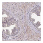 Atlas Antibodies Anti-ABCC10 Antibody